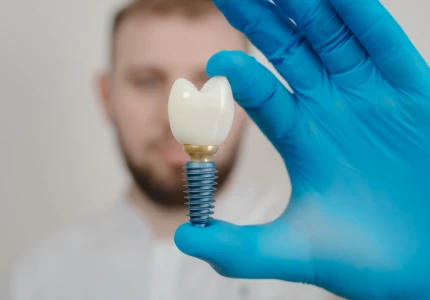 Impianti Dentali